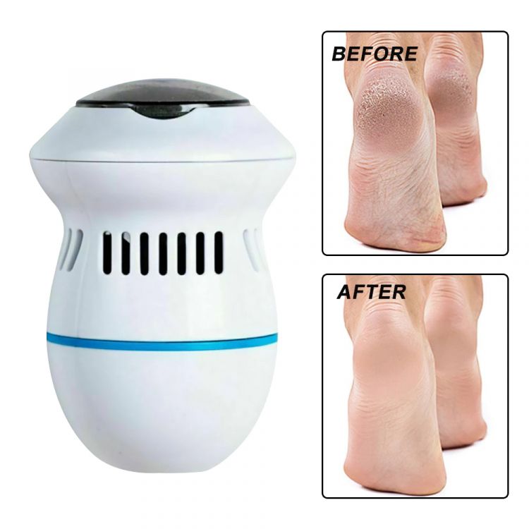 Rechargeable Electric Callus Remover – Salon-Quality Pedicure at Home